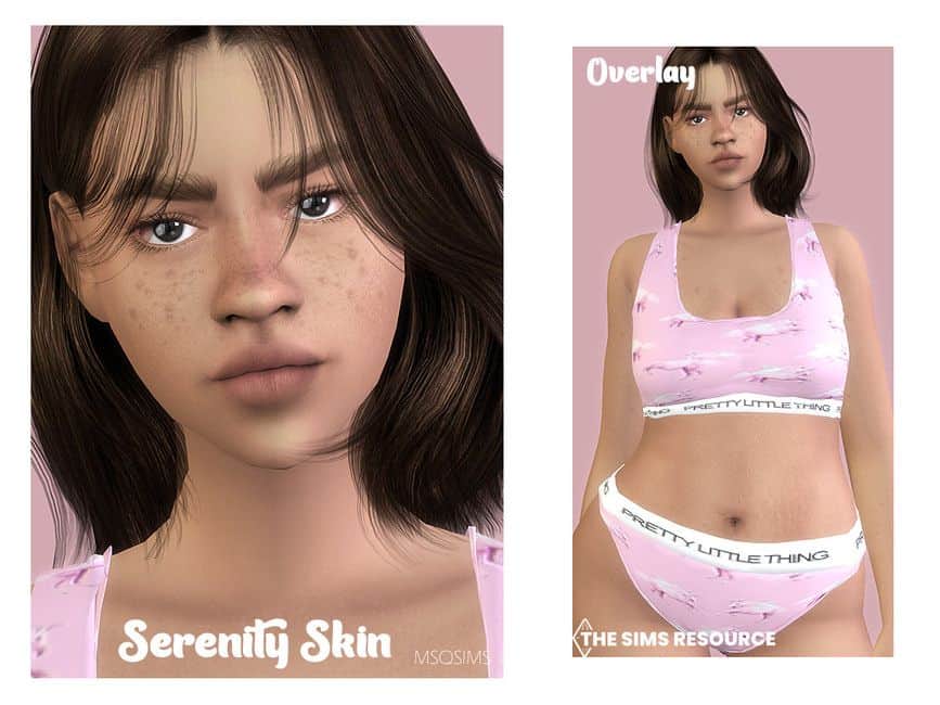 female sim with acne, freckles and stretchmarks