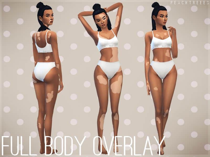 female sims with vitiligo skin patterns