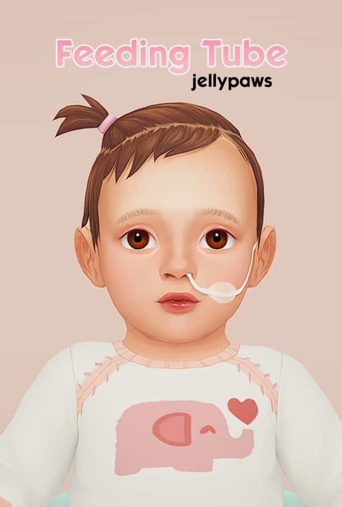 infant with a feeding tube in their nose