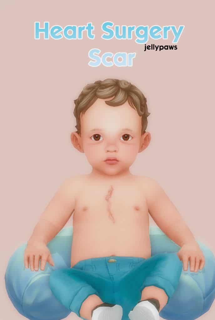 infant sim with a large scar down their chest