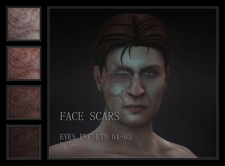 male sim with burn scars on one side of his face