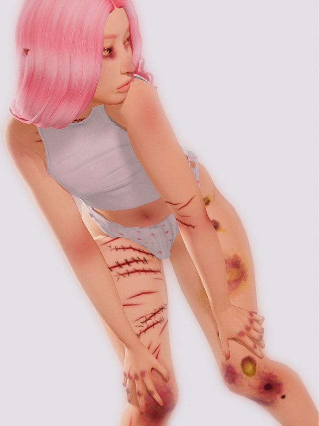 sim with body scars and bruising