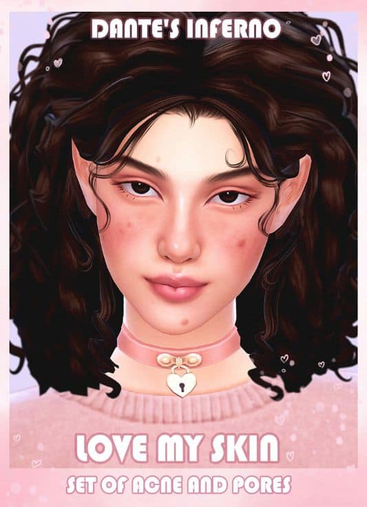 sim with face acne and pores